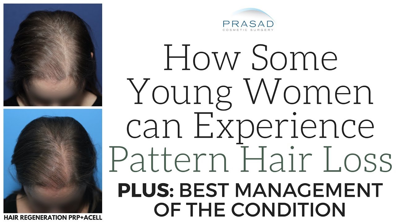 Reasons For Hair Loss In Young Women The Crush Fashion